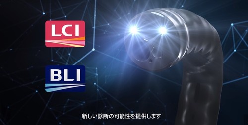 エルクセオ7000紹介イメージ