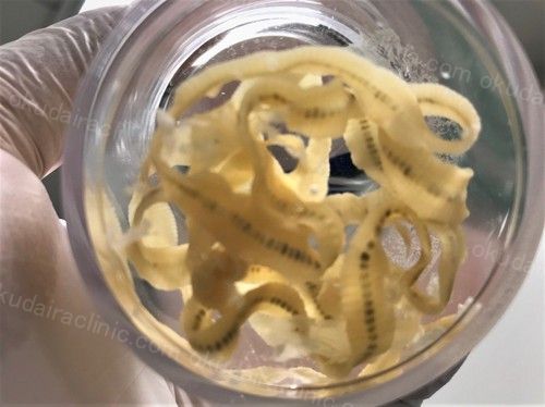 寄生虫事例写真