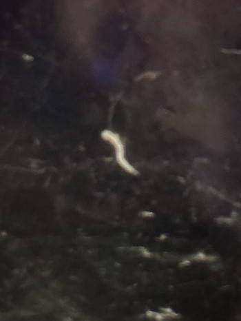 寄生虫事例写真