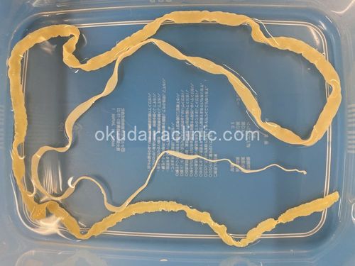 寄生虫事例写真